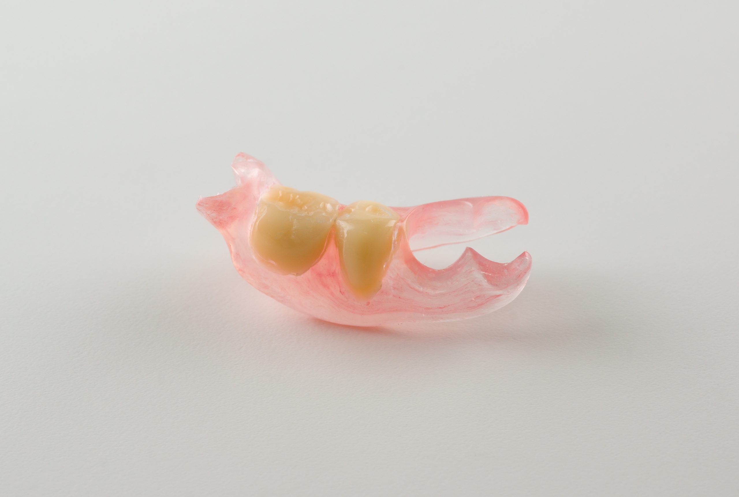 modern nylon removable dental prosthesis for restoring dentition